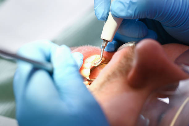 Best Emergency Dental Care for Sports Injuries in West Yellowstone, MT