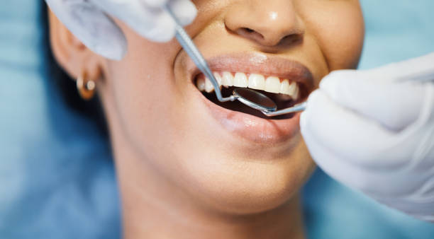 Best Broken or Chipped Tooth Repair in West Yellowstone, MT
